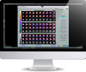 Core sound imaging - Learn more about how Studycast’s medical imaging solution can work for you. Schedule a Demo or call (919) 277-0636! Web-based solutions, or software as a service, for sharing and reading ultrasound images has greatly improved the turnaround time for physicians to read a study and for patients to receive a …